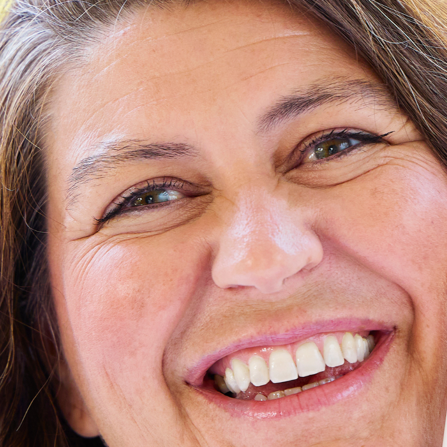 რა სარგებელი მოაქვს ტოპიკრემის AH3 ხაზს?