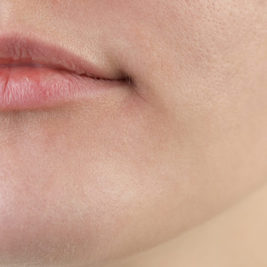 კანის გამოშრობა, ხშირი და უნივერსალური პრობლემა