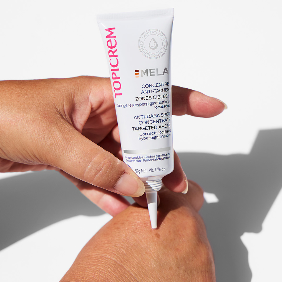 როგორ ჩნდება პიგმენტური ლაქები?