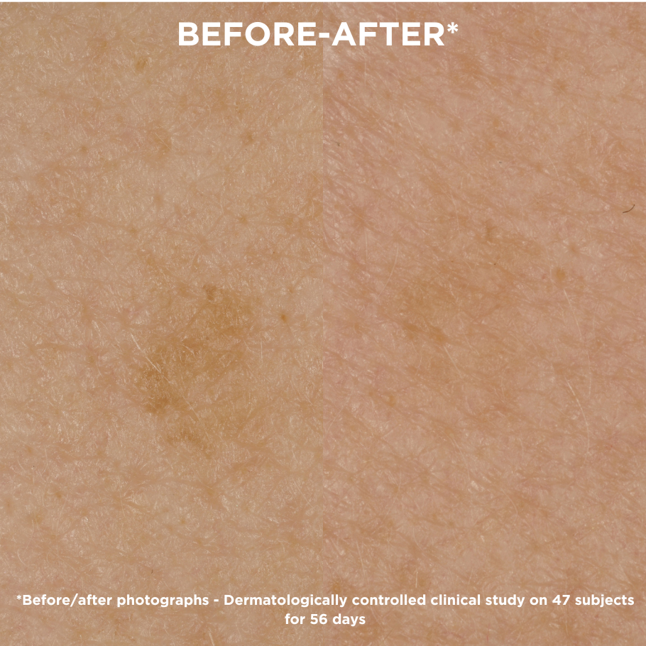 რა სარგებელი აქვს TOPICREM MELA ხაზს?