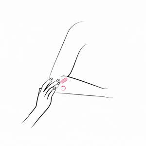 3. წაისვით იარებზე/ნაწიბურებზე