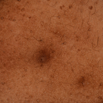 ტოპიკრემი - პიგმენტური ლაქების საწინააღმდეგო დღის კრემი SPF50+ გამოყენებამდე*